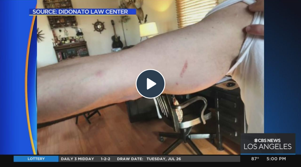 More lawsuits against Dodgers filed for alleged security guard abuses of fans